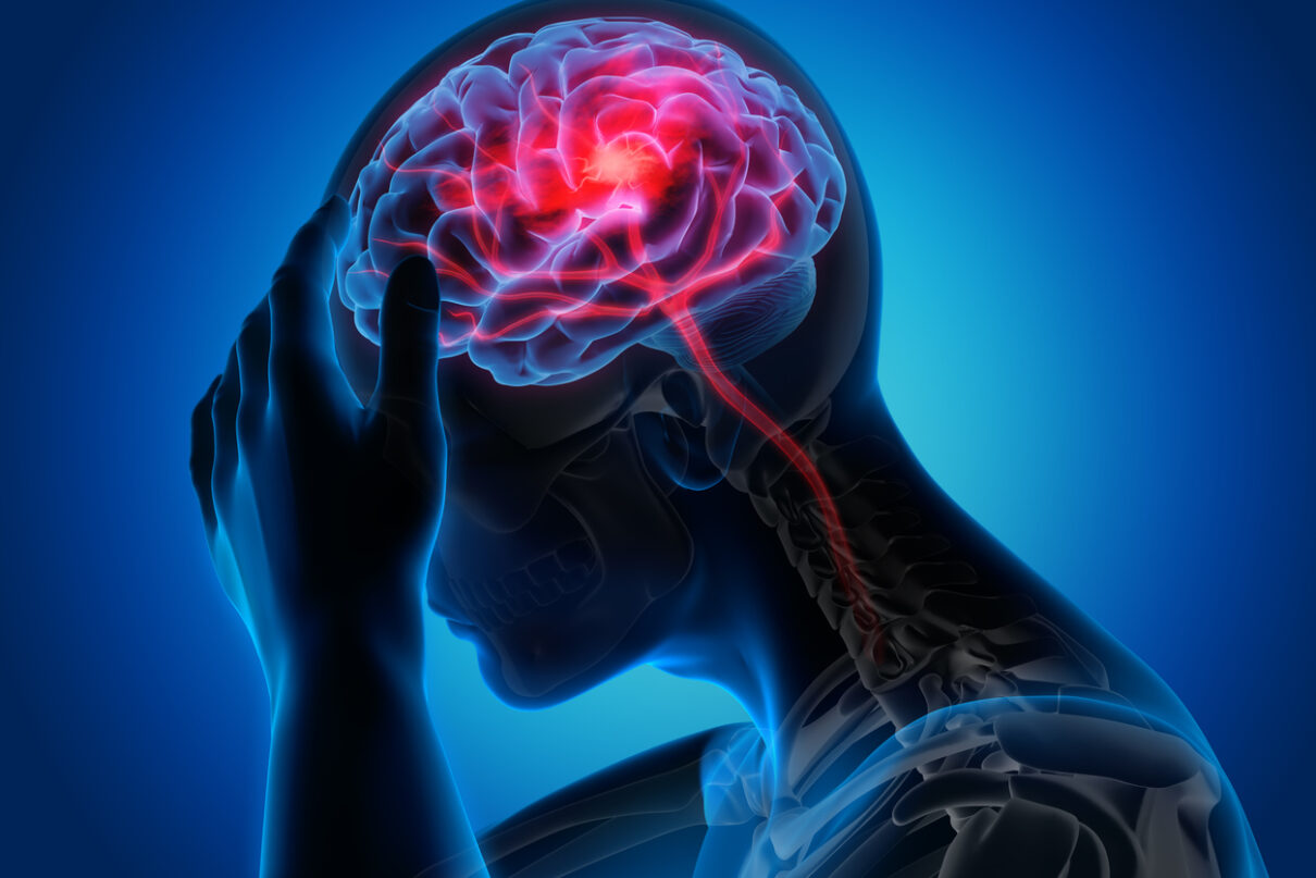 When is a Hospital Accountable for My Stroke Injuries?