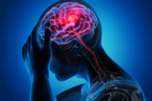 When is a Hospital Accountable for My Stroke Injuries?